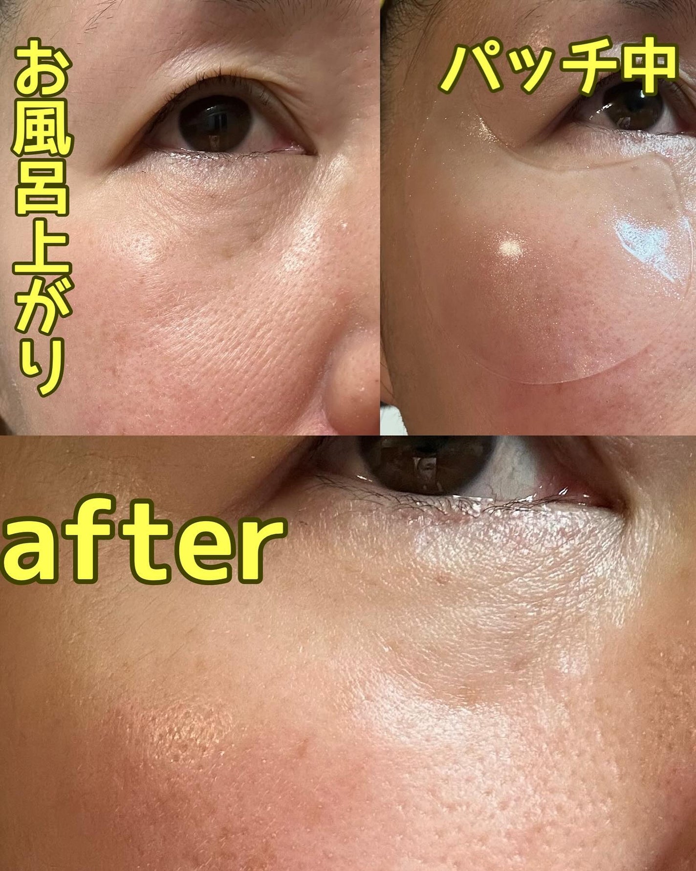 グルタチオン光彩白玉パッチ/SNP/アイケア・アイクリームを使ったクチコミ(3枚目)