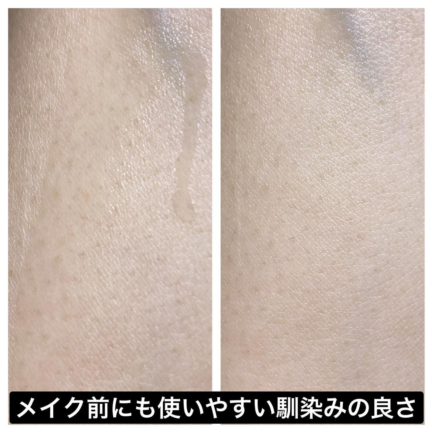 ガラク ナイアシン 3.0 エッセンス/manyo/美容液を使ったクチコミ(5枚目)