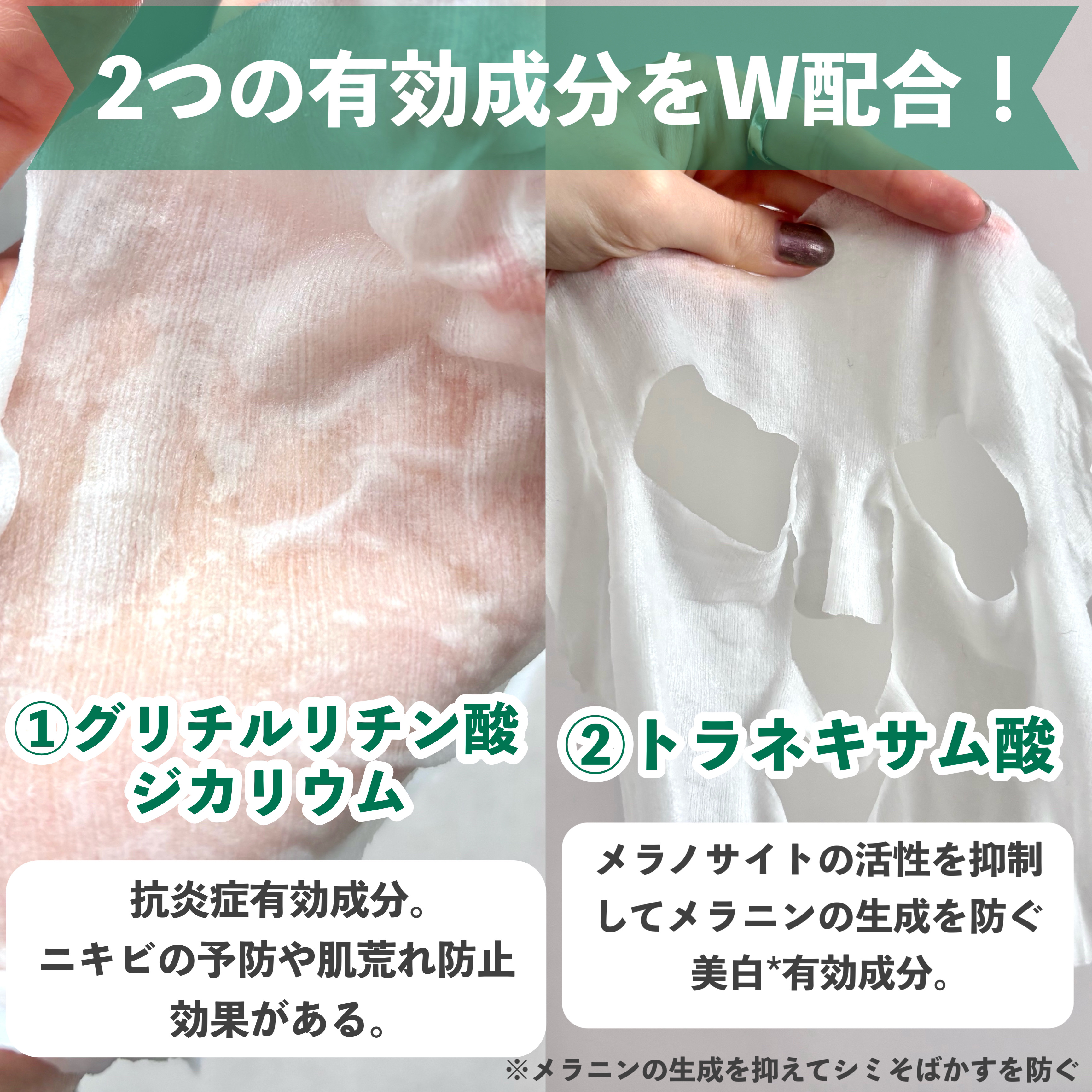 薬用ルルルン 美白アクネ/ルルルン/シートマスク・パックを使ったクチコミ（3枚目）