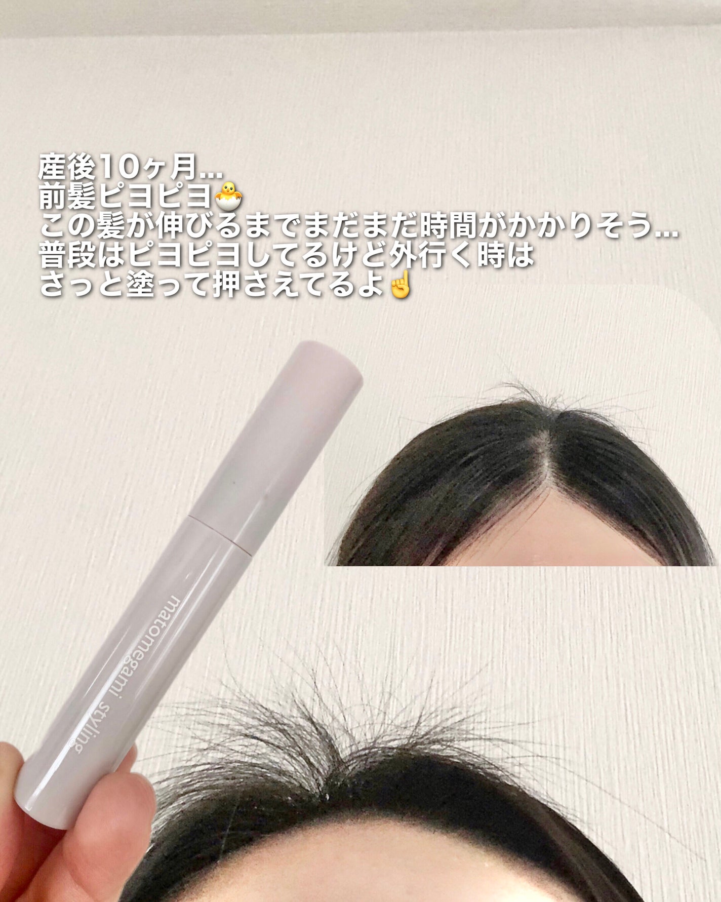 riko on LIPS 「産後脱毛その後....ぴよぴよの毛が大量発生!DAISO発見し..」(3枚目)