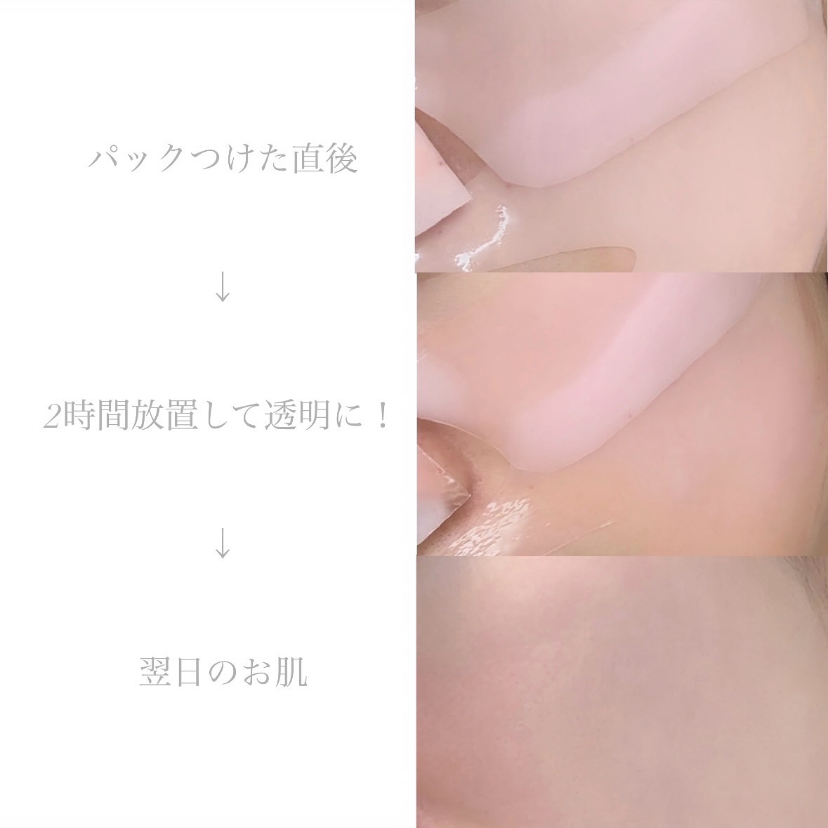 キングスベリービタコラーゲンマスク/hince/シートマスク・パックを使ったクチコミ（3枚目）