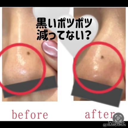 A1カーミング アンプル/VT/美容液を使ったクチコミ(7枚目)