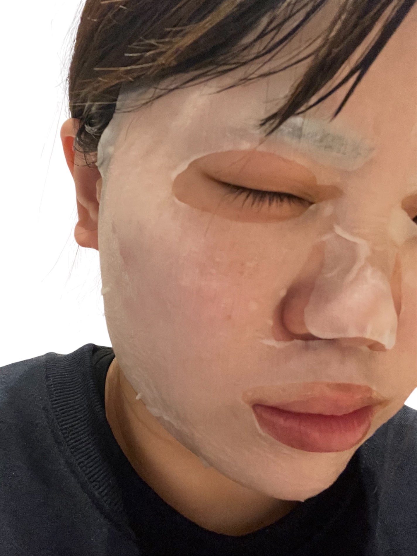 薬用ルルルン 美白アクネ/ルルルン/シートマスク・パックを使ったクチコミ(4枚目)