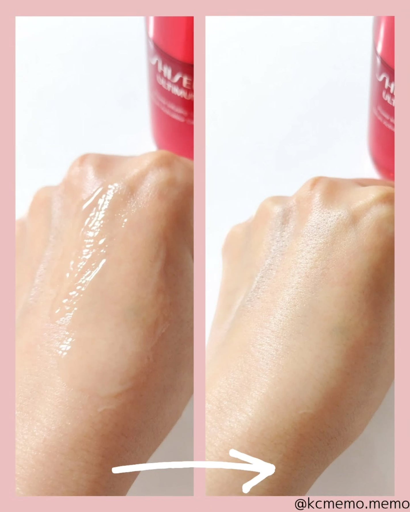 アルティミューン™ パワライジング セラム/SHISEIDO/美容液を使ったクチコミ(4枚目)