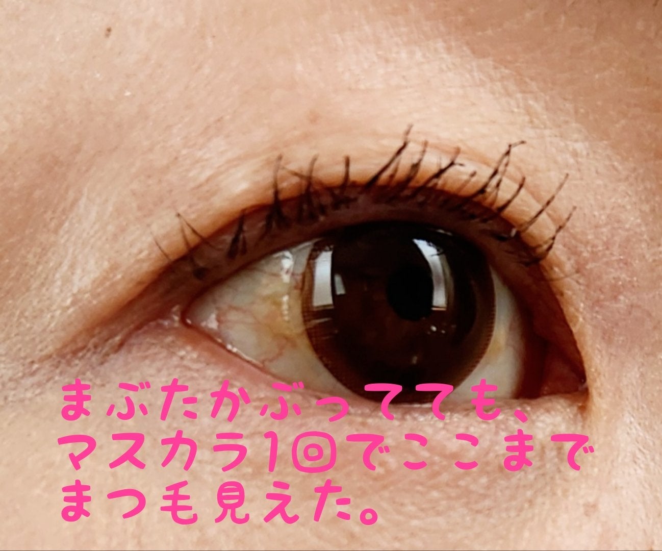 ひとえ・奥ぶたえ用カーラー/アイプチ®/ビューラーを使ったクチコミ(4枚目)