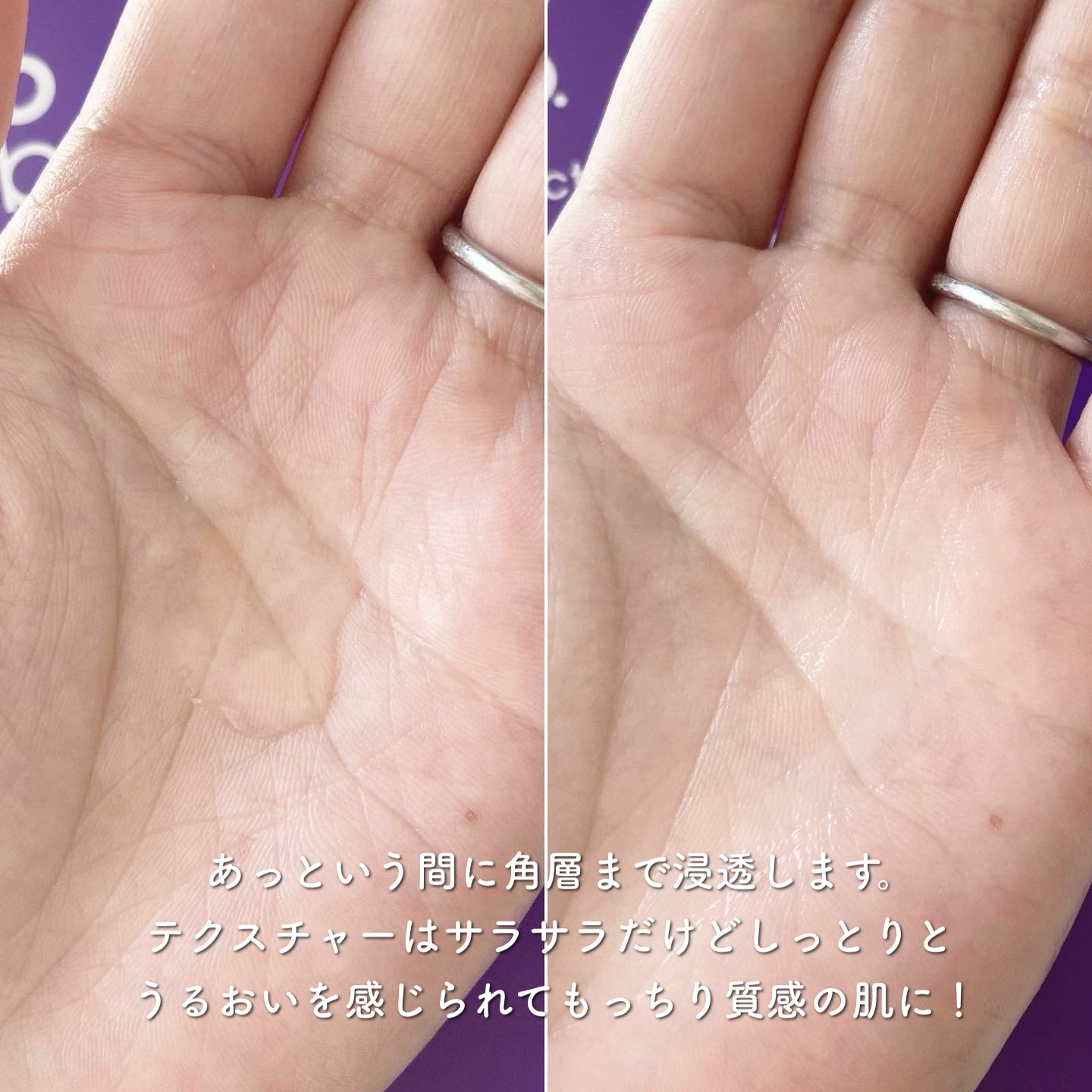 水溶性プラセンタエキス原液/Bb lab./美容液を使ったクチコミ（2枚目）