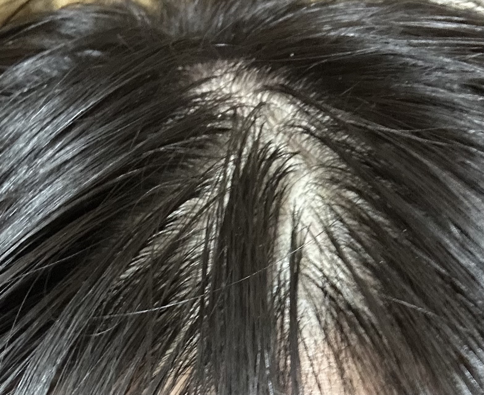 頭皮保湿ローション/キュレル/頭皮ローションを使ったクチコミ（2枚目）