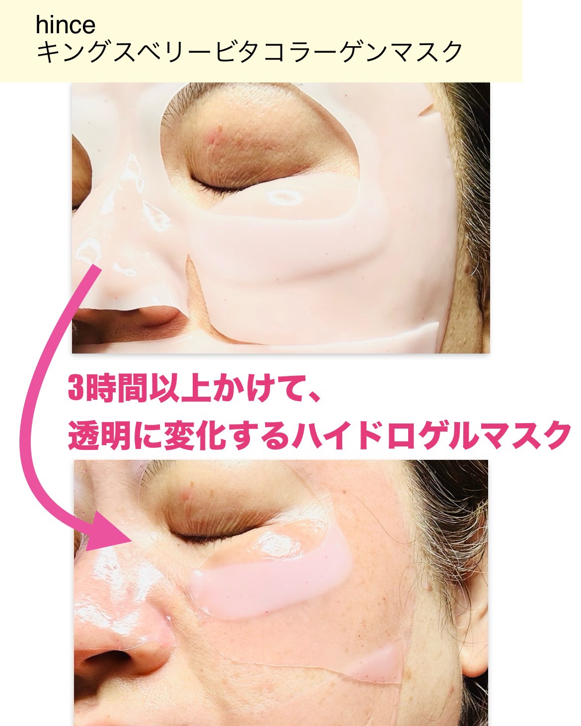 キングスベリービタコラーゲンマスク/hince/シートマスク・パックを使ったクチコミ（2枚目）