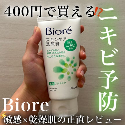 スキンケア洗顔料 薬用アクネケア/ビオレ/洗顔フォームを使ったクチコミ(1枚目)