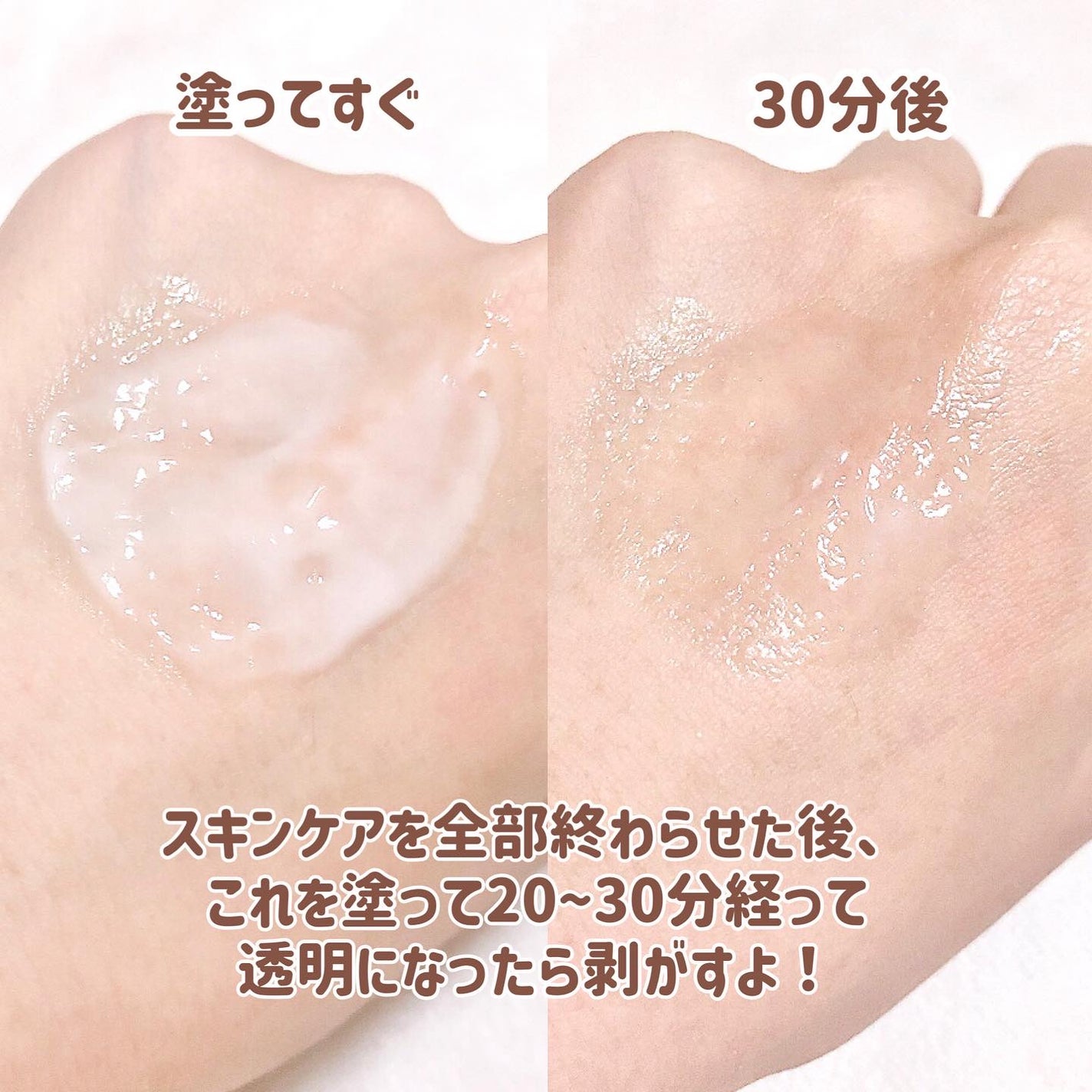 ピートピーディーアールエヌ ラッピングショット フィールオフマスク/One-day's you/シートマスク・パックを使ったクチコミ(3枚目)