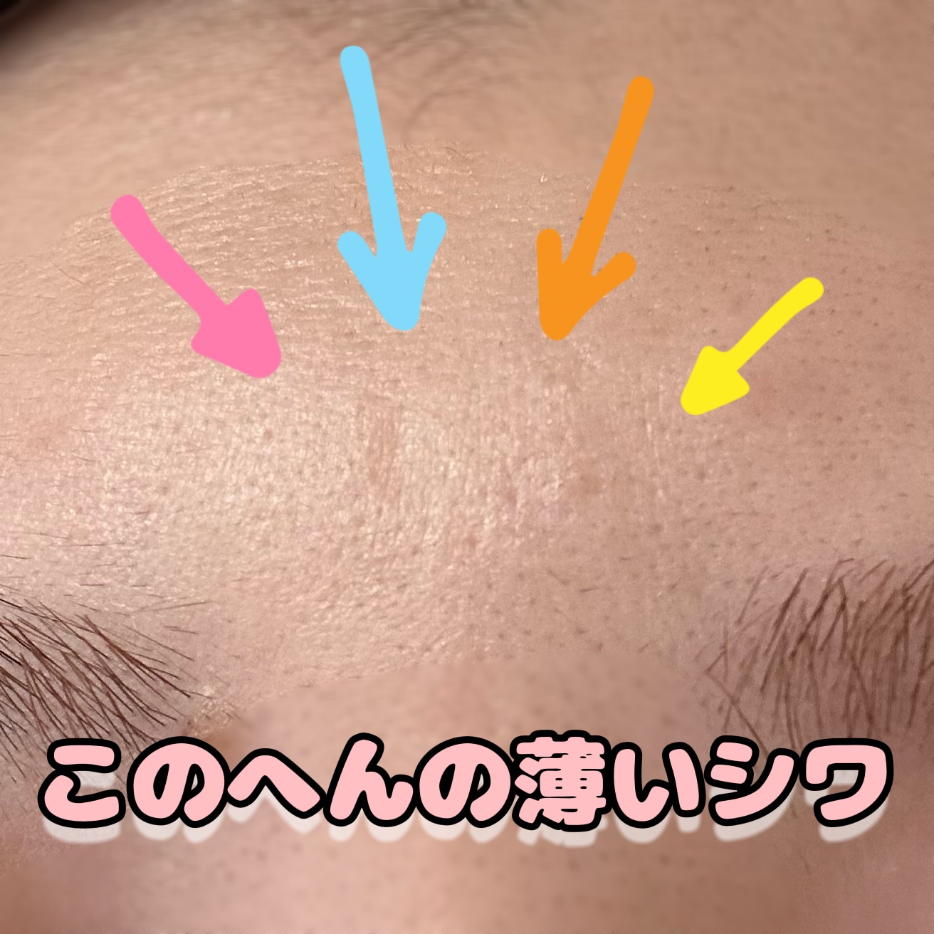 レチノパワー リンクルクリーム /エリクシール/アイケア・アイクリームを使ったクチコミ（3枚目）