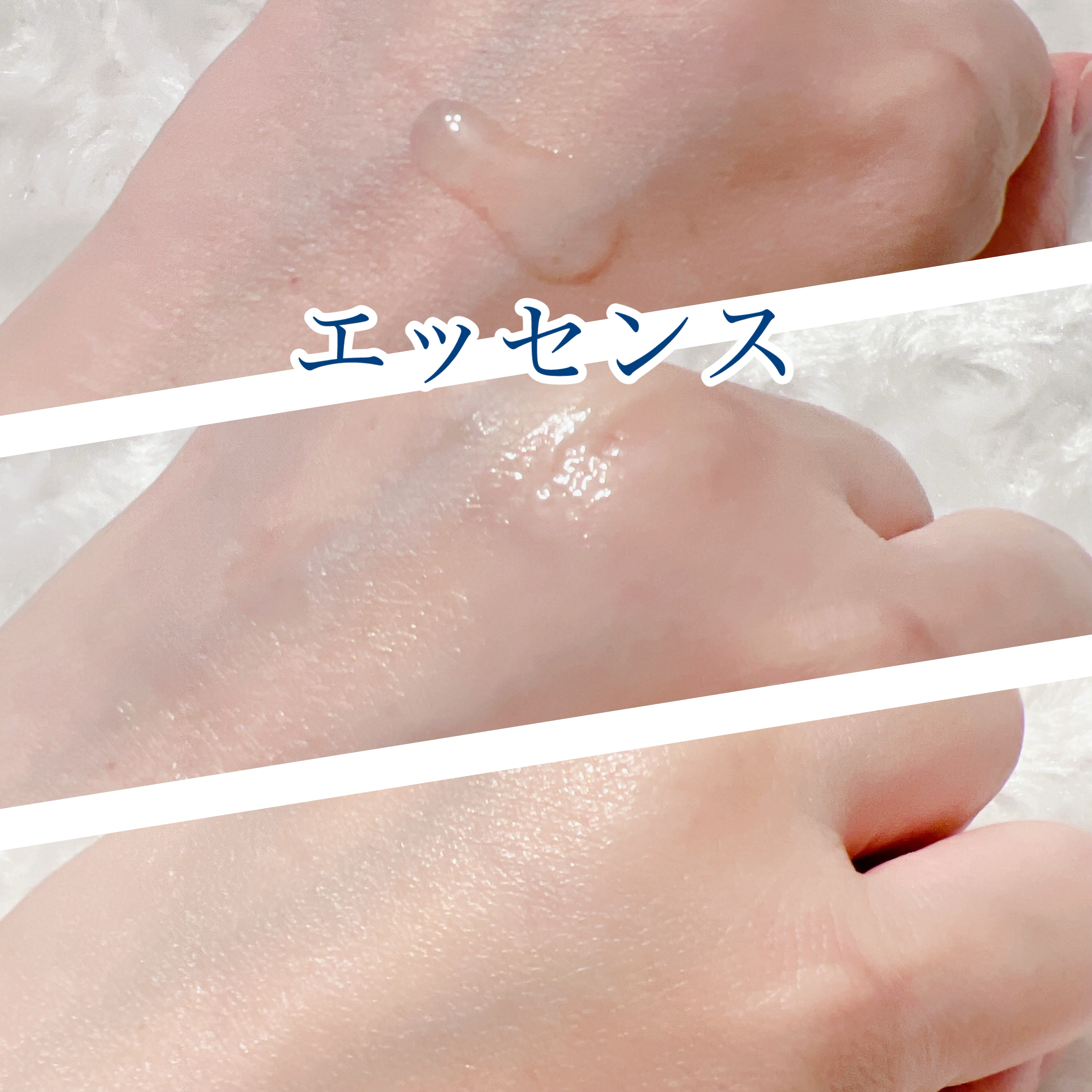 グルカミューンエッセンス /VT/美容液を使ったクチコミ（3枚目）