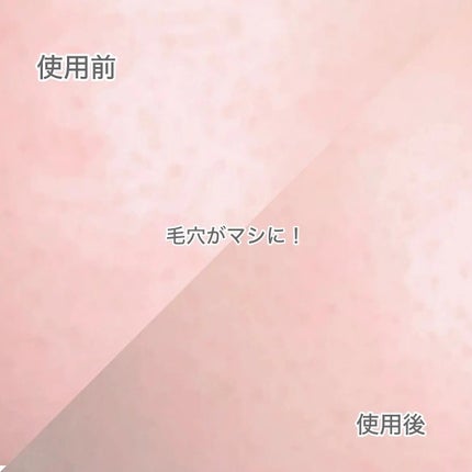 A1カーミング アンプル/VT/美容液を使ったクチコミ(4枚目)