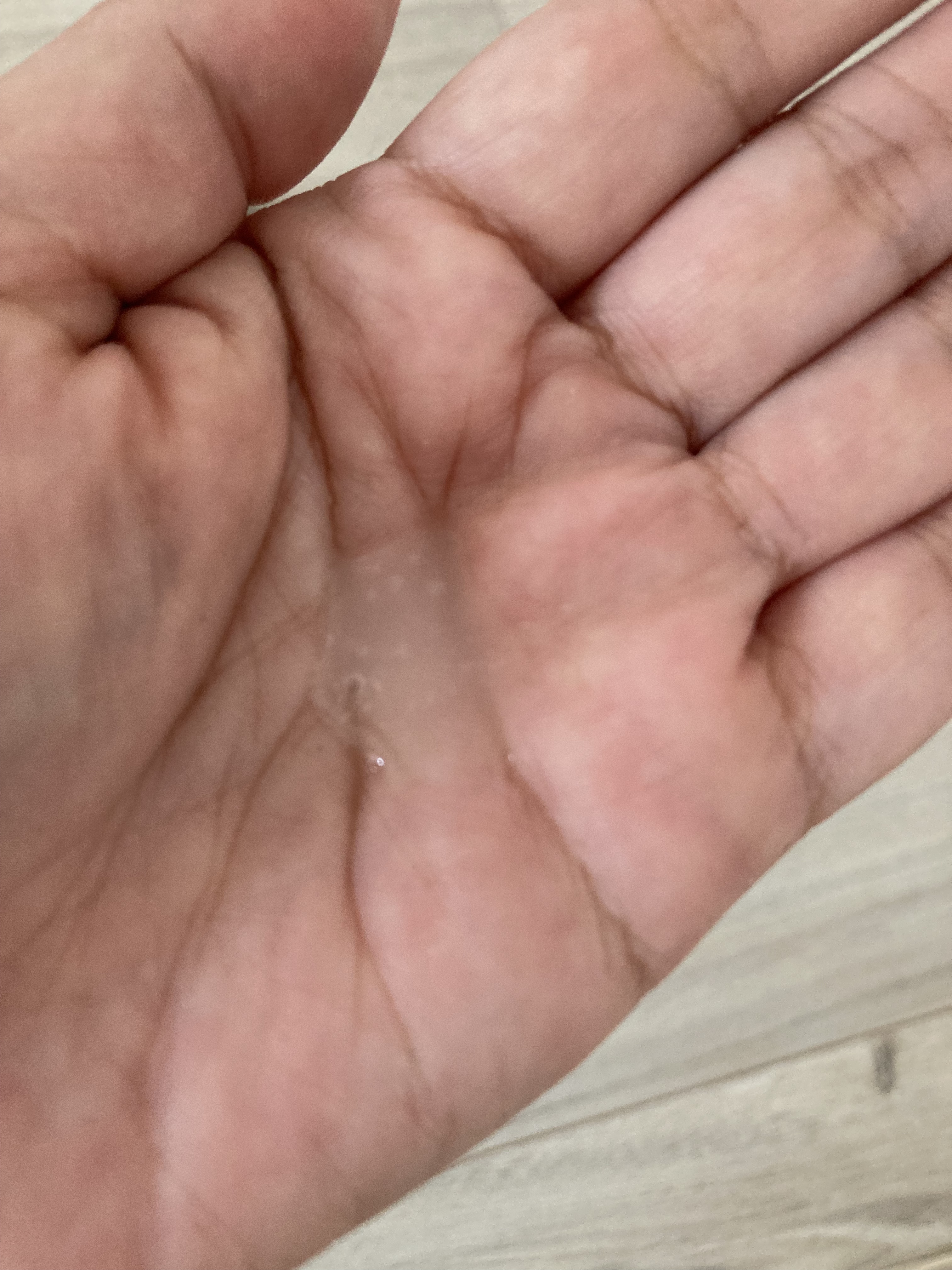 アルティミューン™ パワライジング セラム/SHISEIDO/美容液を使ったクチコミ（3枚目）