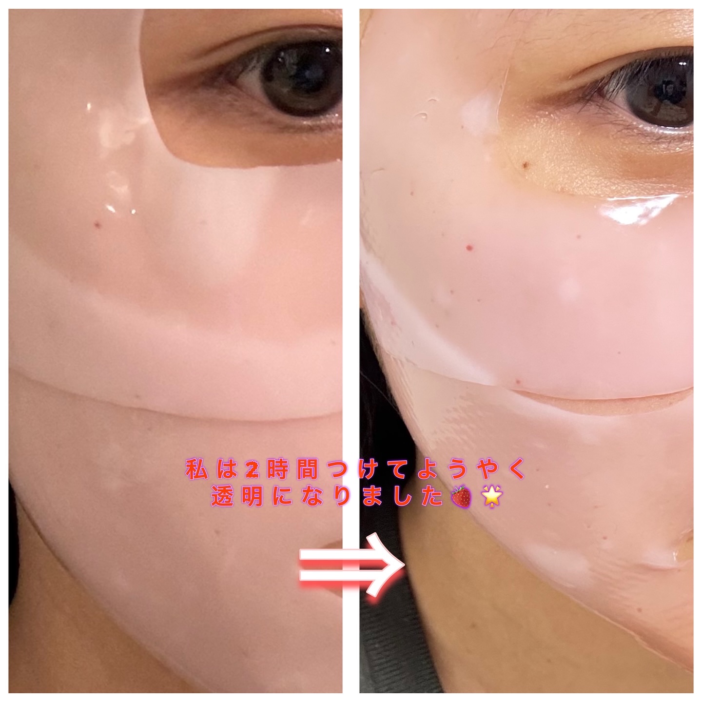 キングスベリービタコラーゲンマスク/hince/シートマスク・パックを使ったクチコミ（3枚目）