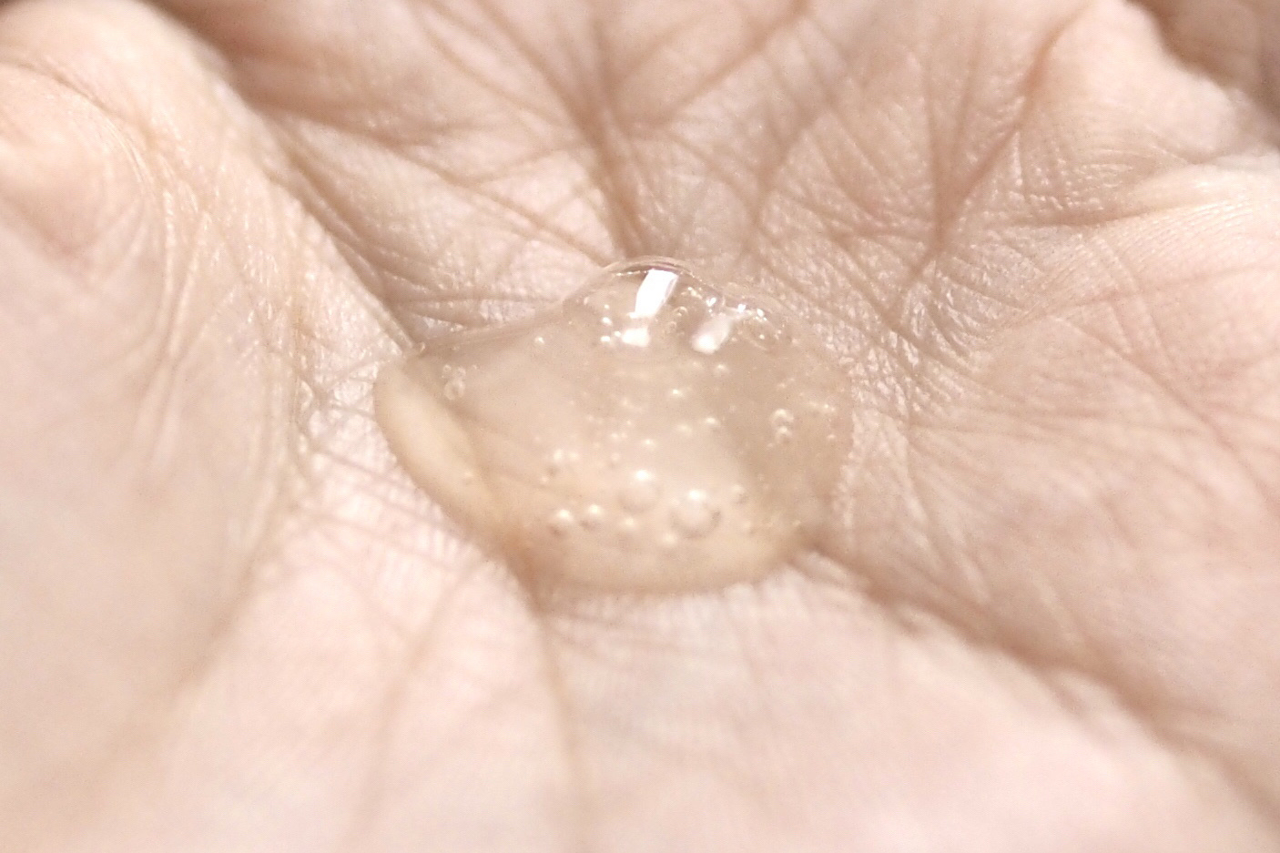 ブレミッシュケアアップ セラム/ISOI/美容液を使ったクチコミ（3枚目）