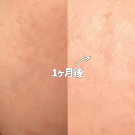 サミュ ガラクトポア オーツートナー/SAM'U/化粧水を使ったクチコミ(5枚目)