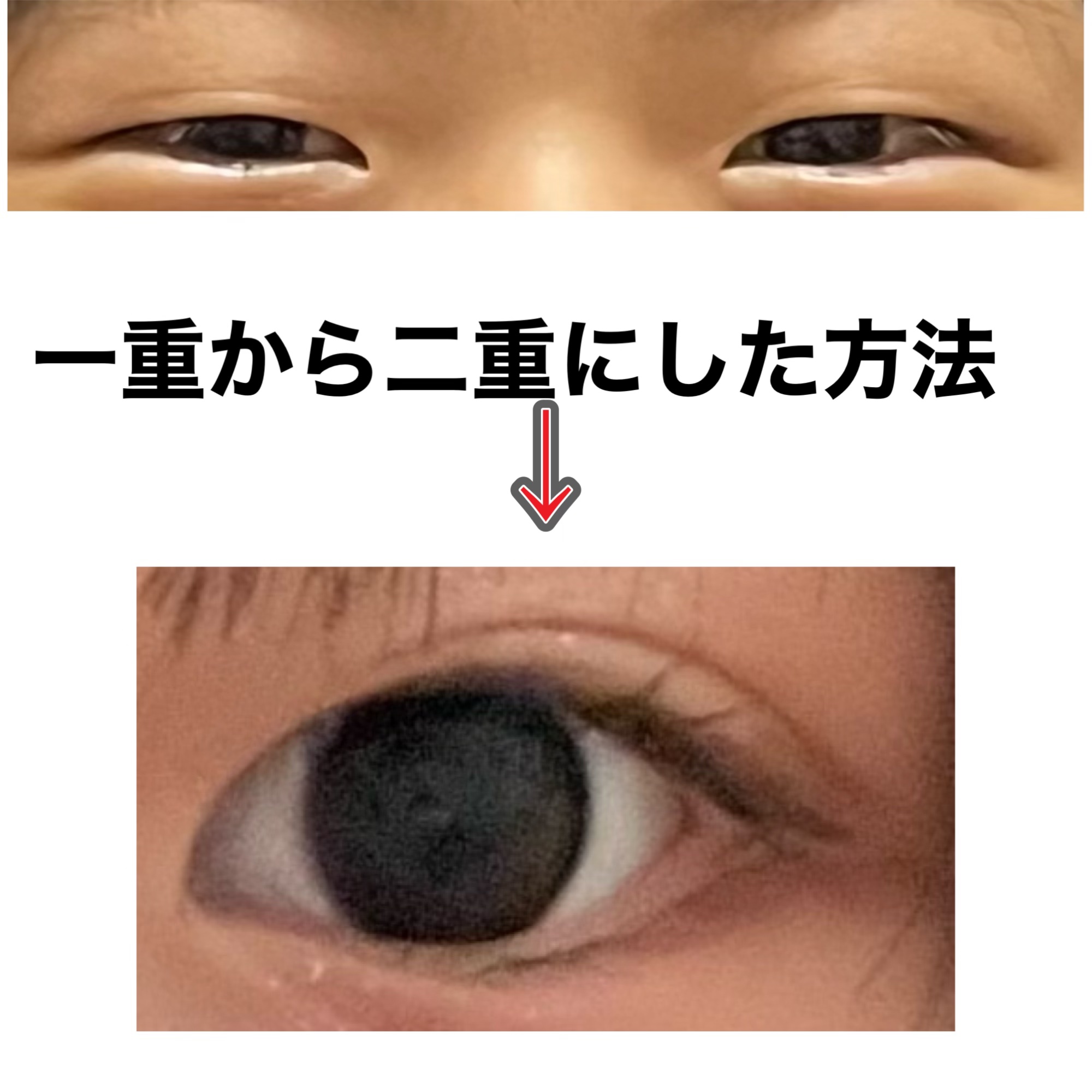ワンダーアイリッドテープ Extra/D-UP/二重まぶた用アイテムを使ったクチコミ（1枚目）