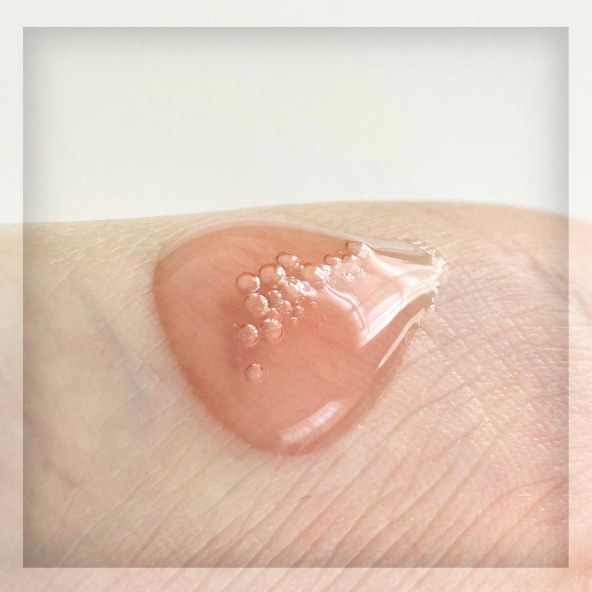 Dr.ROSA IV アンプル3種セット/Dr.ROSA/スキンケアキットを使ったクチコミ(3枚目)