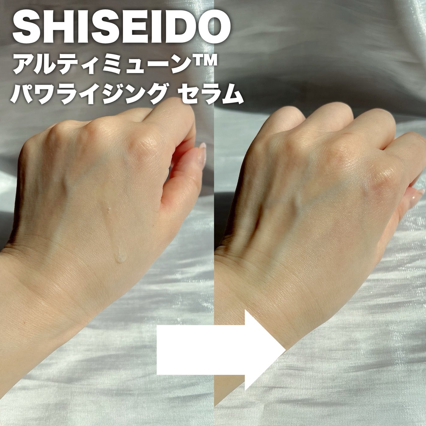 アルティミューン™ パワライジング セラム/SHISEIDO/美容液を使ったクチコミ(3枚目)