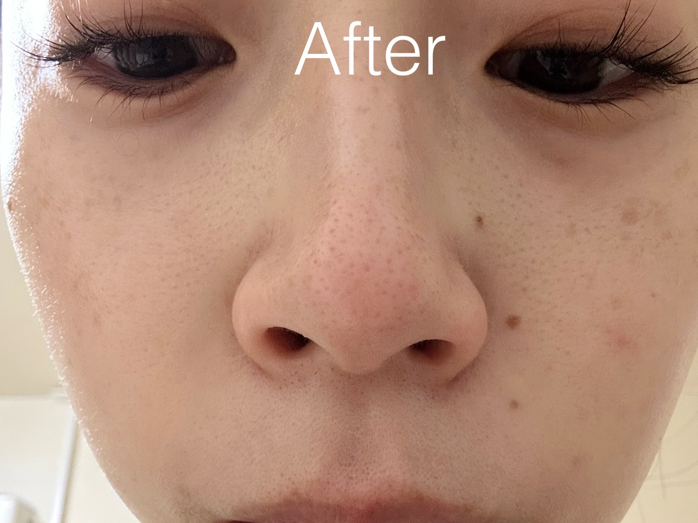 フェイススチーマー2 WH/ニトリ/美顔器・マッサージを使ったクチコミ（3枚目）