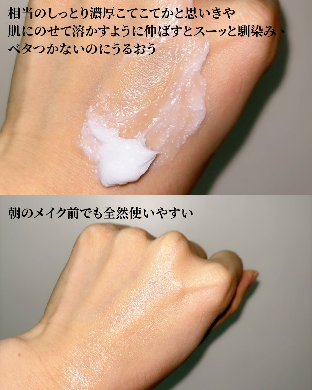 アトバリア365クリーム/AESTURA/フェイスクリームを使ったクチコミ(5枚目)