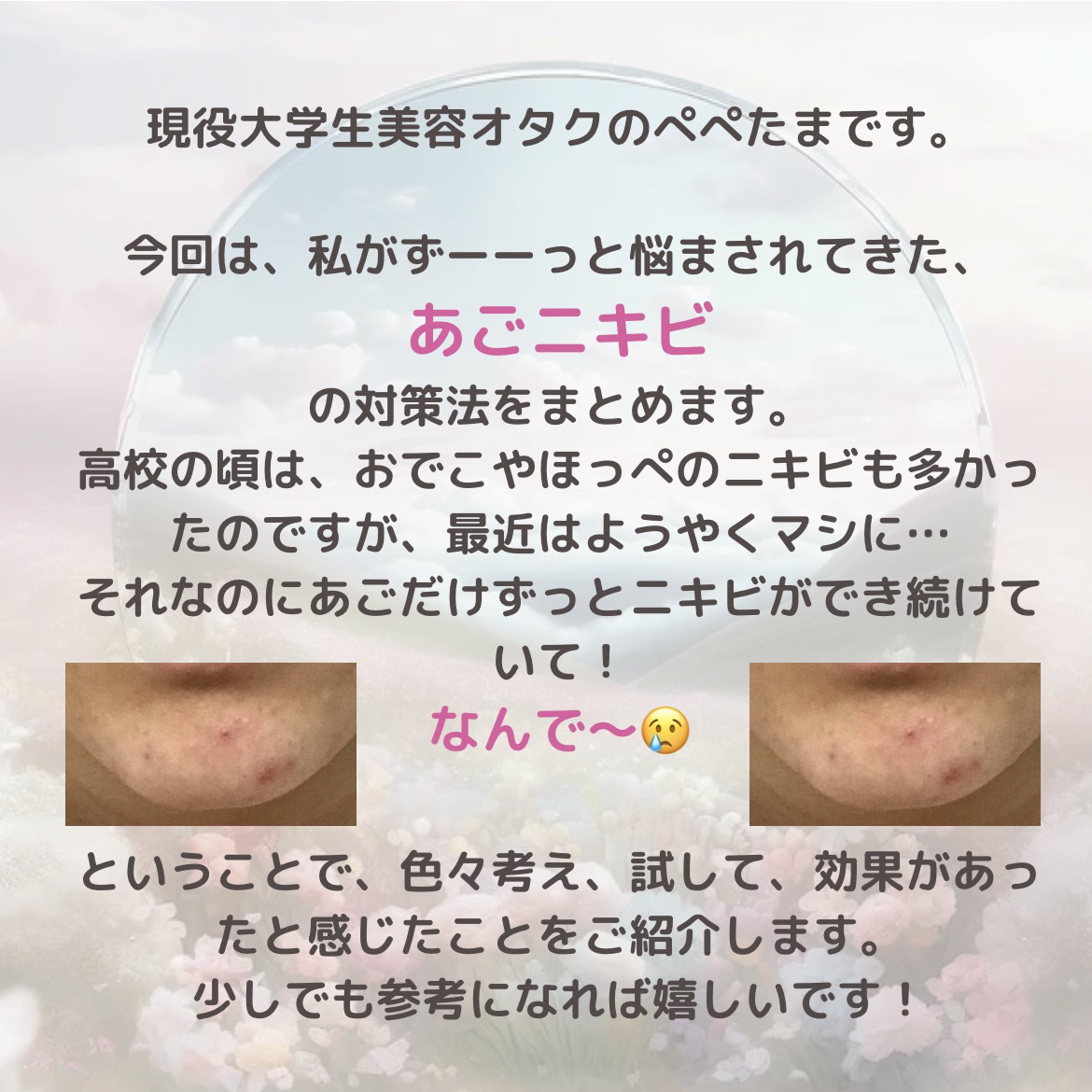 DHC マルチビタミン/DHC/美容サプリメントを使ったクチコミ（2枚目）