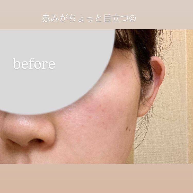 ポア ブライトニング シミケアセラム/celimax/美容液を使ったクチコミ（2枚目）