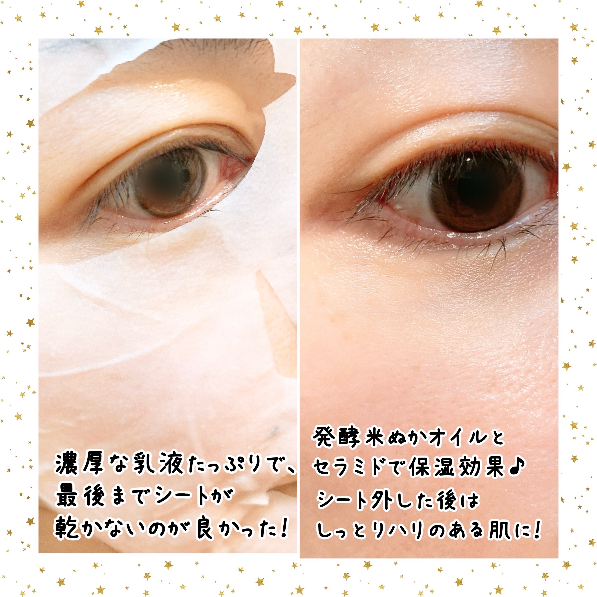 ライス70インテンシブモイスチャーライジングミルクマスク/Anua/シートマスク・パックを使ったクチコミ（2枚目）