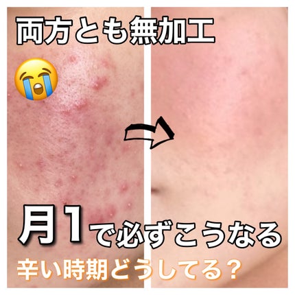 命の母ホワイト(医薬品)/命の母/その他を使ったクチコミ(1枚目)