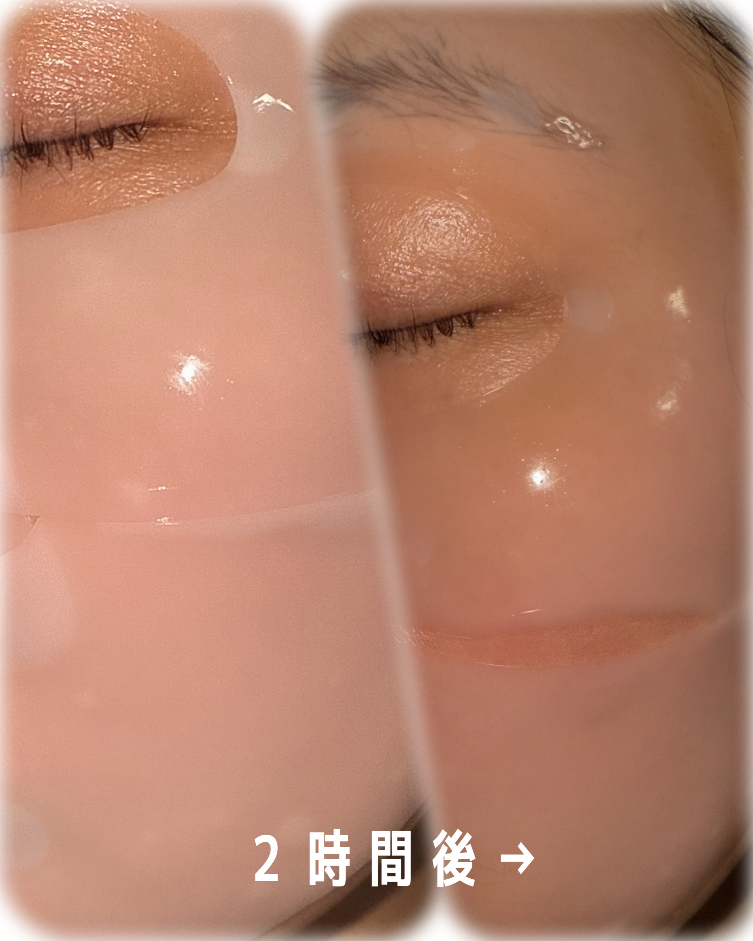 コラーゲンバウンスアップハイパーアクティブゲルマスク/SNP/シートマスク・パックを使ったクチコミ（3枚目）