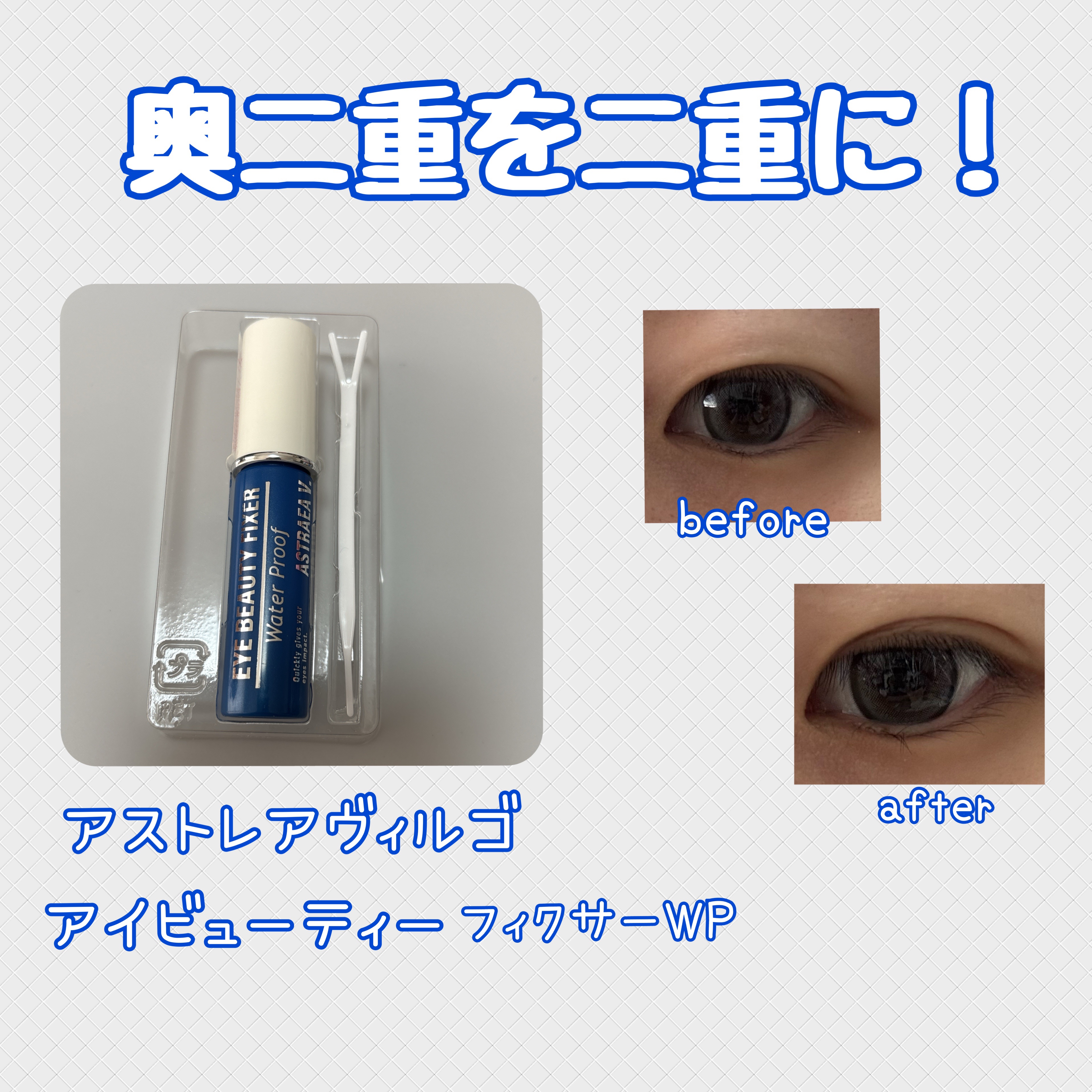 アイビューティー フィクサー WP/アストレア ヴィルゴ/二重まぶた用アイテムを使ったクチコミ（1枚目）