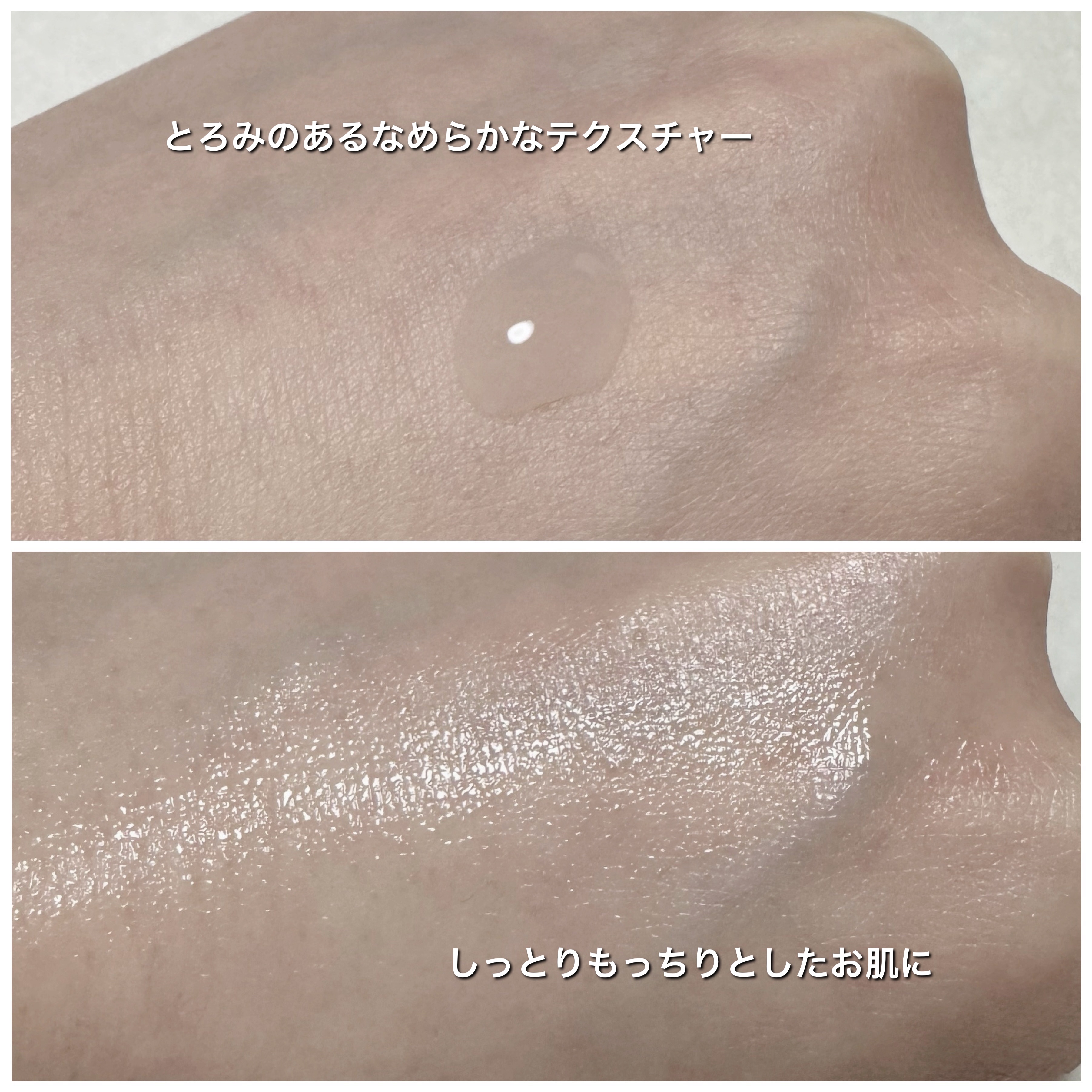 アルティミューン™ パワライジング セラム/SHISEIDO/美容液を使ったクチコミ（3枚目）