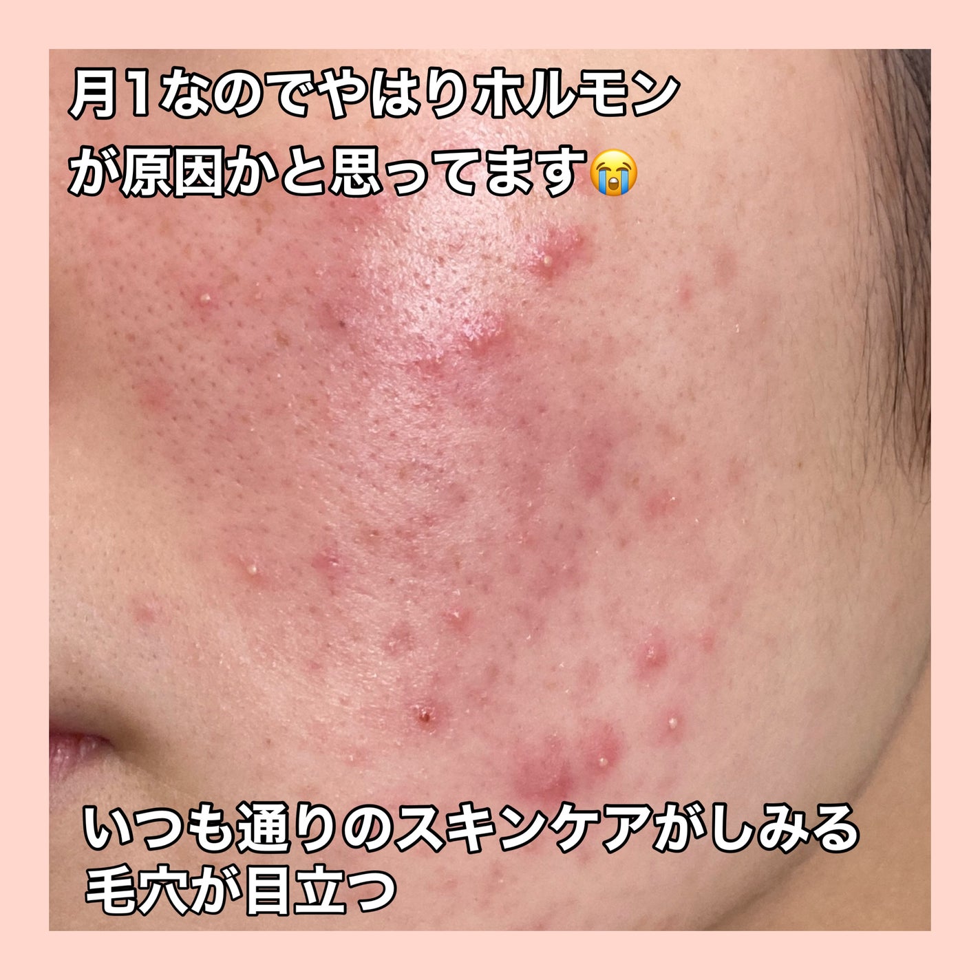 命の母ホワイト(医薬品)/命の母/その他を使ったクチコミ(2枚目)