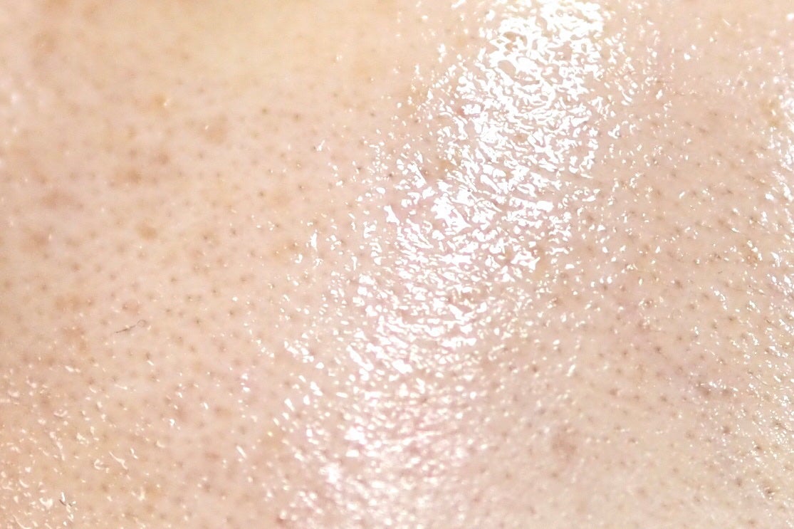 ポーラ リンクルショット メディカル セラム デュオ/リンクルショット/美容液を使ったクチコミ(5枚目)