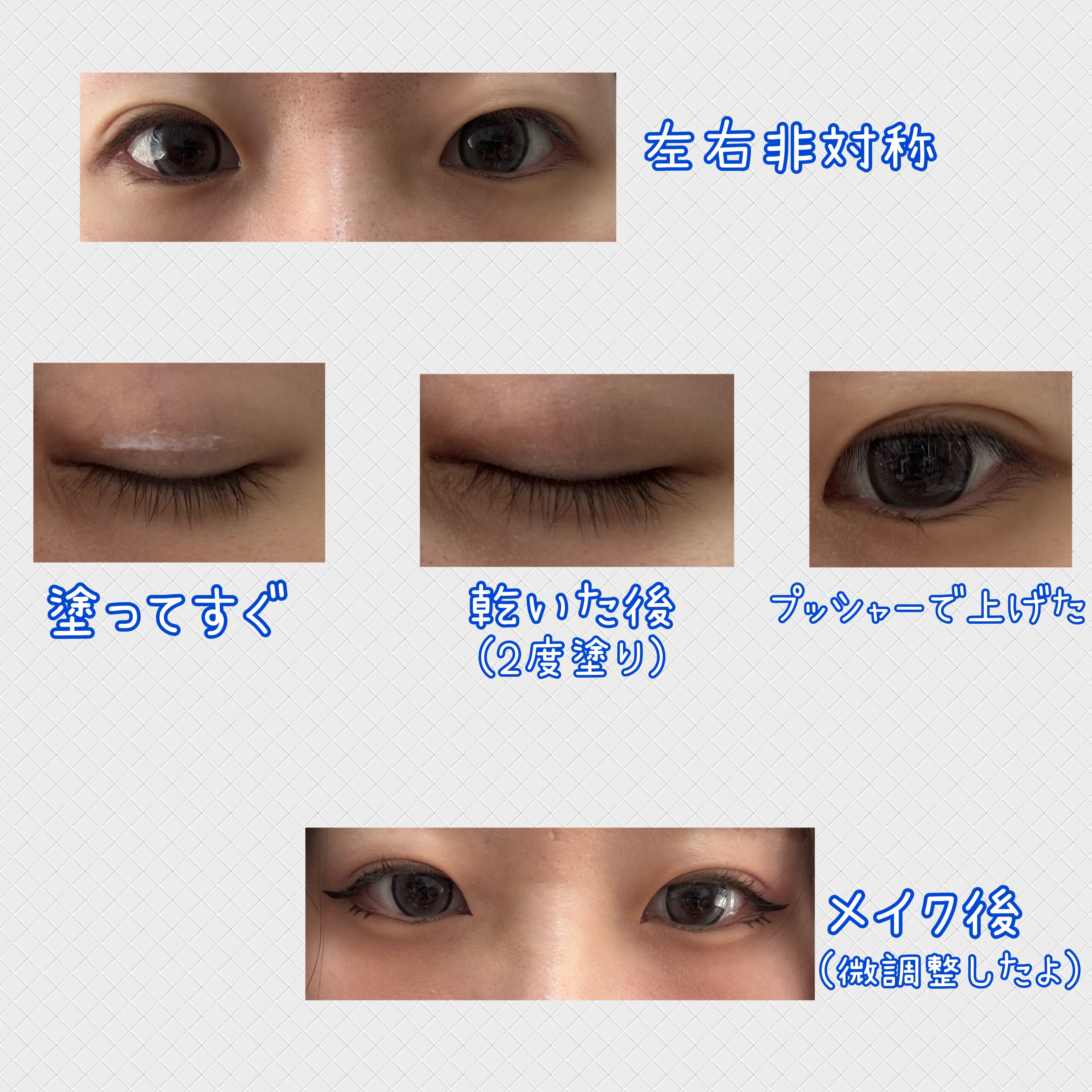 アイビューティー フィクサー WP/アストレア ヴィルゴ/二重まぶた用アイテムを使ったクチコミ（2枚目）