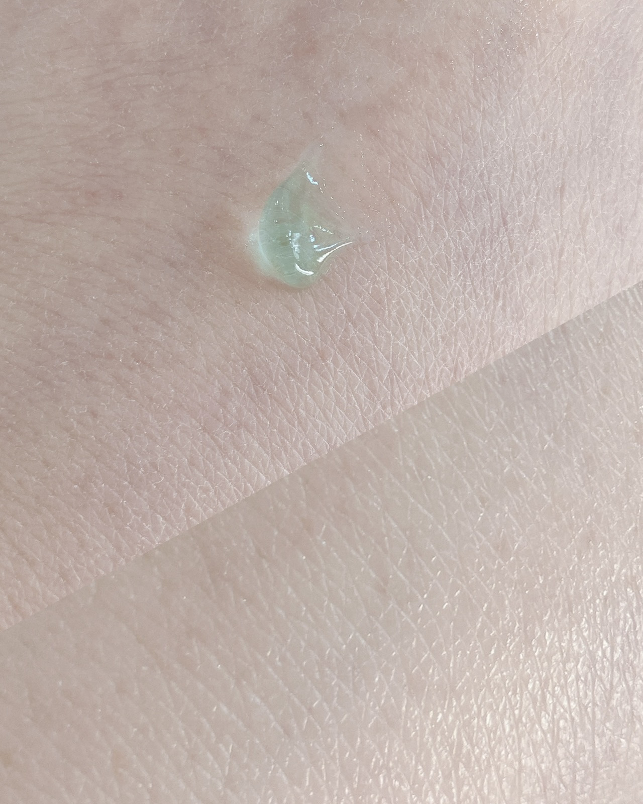 PLACENTREX EXTRACT GEL（ヒトプラセンタジェル）/Placentrex/その他を使ったクチコミ（3枚目）