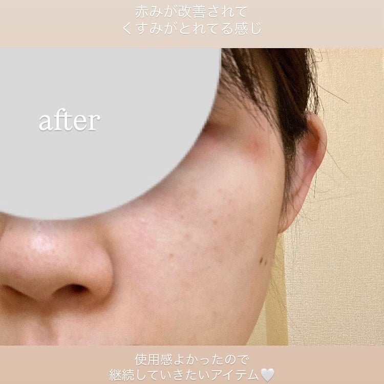 ポア ブライトニング シミケアセラム/celimax/美容液を使ったクチコミ(3枚目)