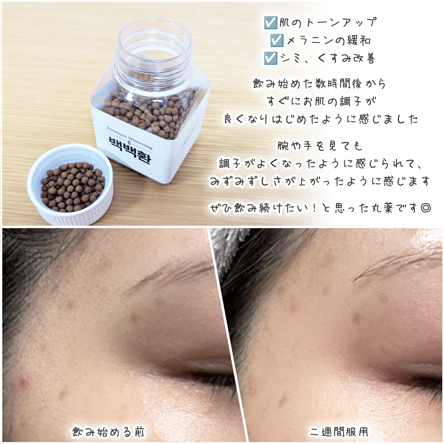 白白丸/ミオル韓医院/美容サプリメントを使ったクチコミ（3枚目）