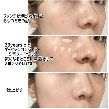 ダーマシンコンシーラー/23years old/リキッドコンシーラーを使ったクチコミ(4枚目)