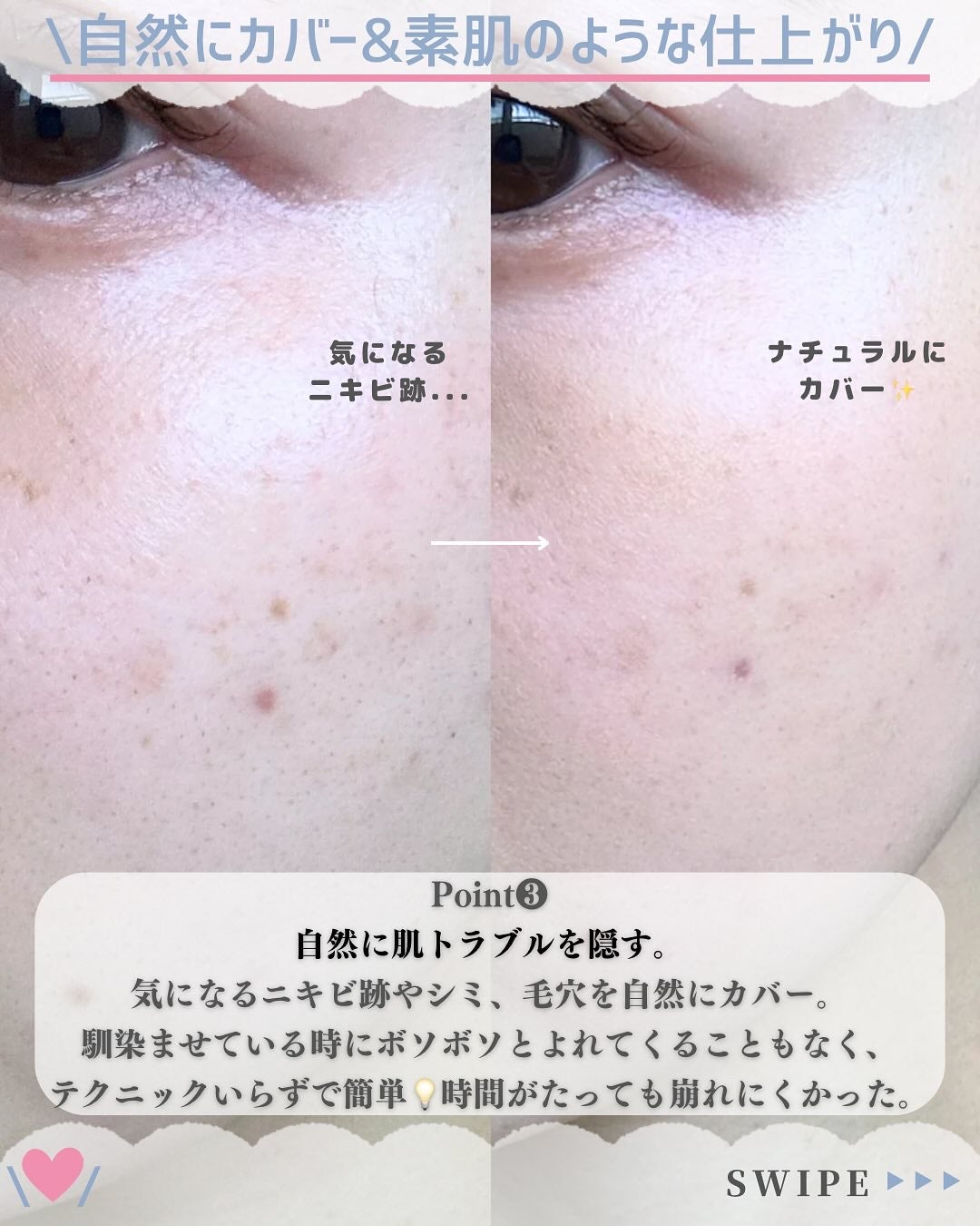 ディセンシア ハイカバーフィット コンシーラー/DECENCIA/リキッドコンシーラーを使ったクチコミ(5枚目)