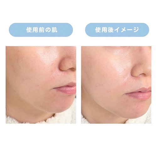 ディセンシア ハイカバーフィット コンシーラー/DECENCIA/リキッドコンシーラーを使ったクチコミ（3枚目）