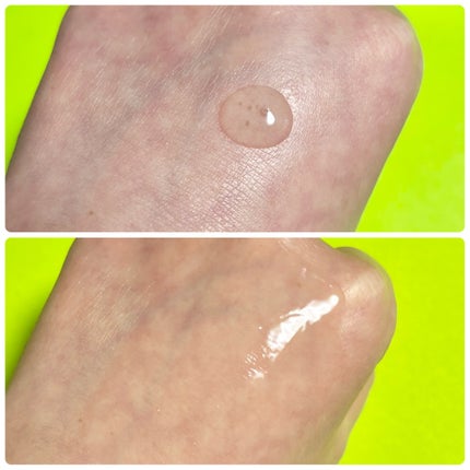 ノスカナイン トラブル セラム/FATION/美容液を使ったクチコミ(5枚目)