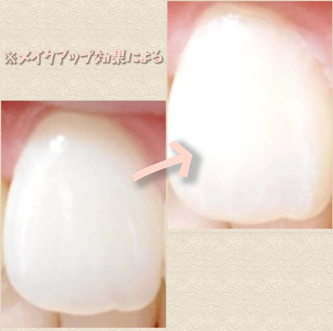 ハニックDC スノー/ハニック・ホワイトラボ/その他オーラルケアを使ったクチコミ(4枚目)