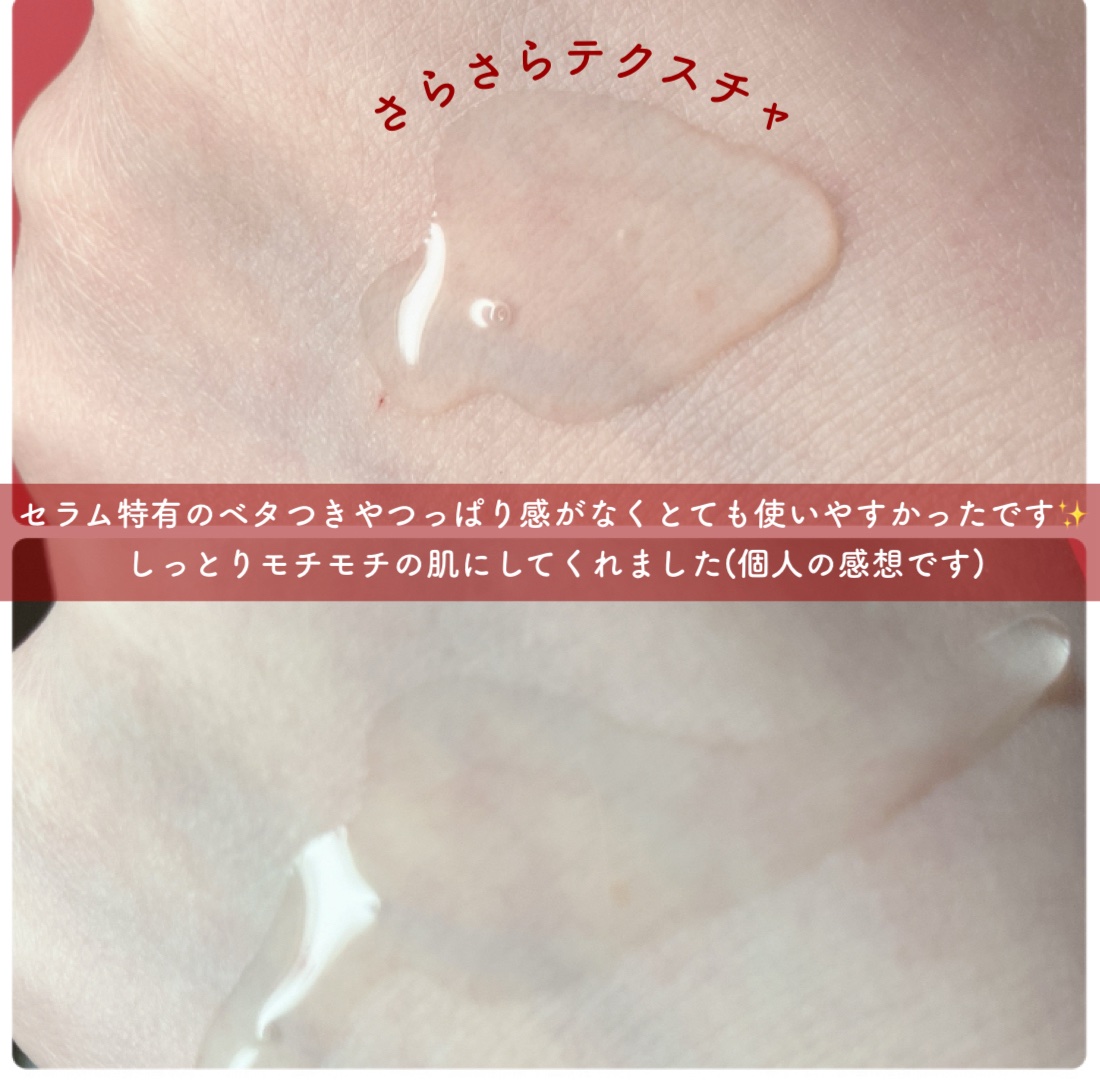 AZアゼライン酸15セラム/コスデバハ/美容液を使ったクチコミ（3枚目）