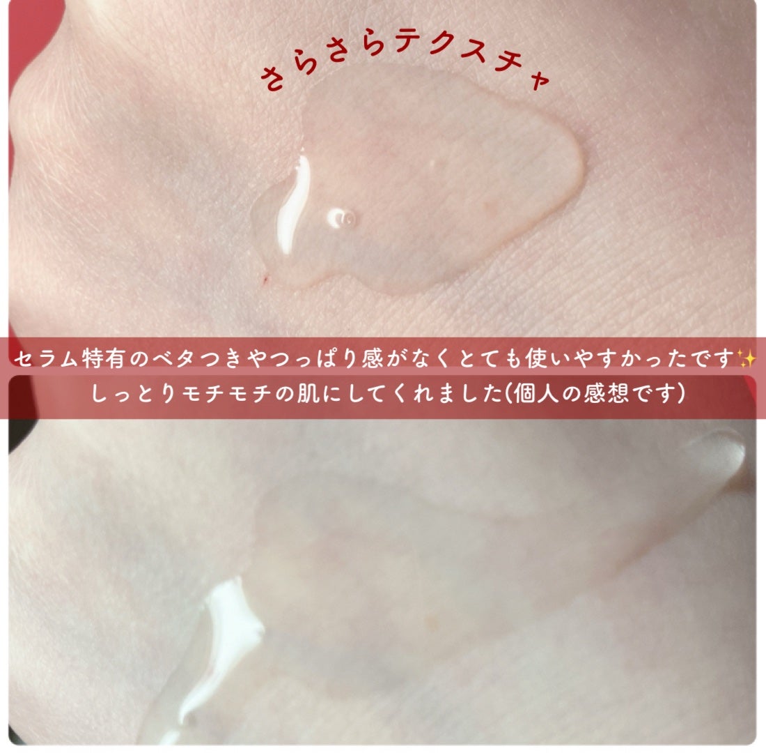AZアゼライン酸15セラム/コスデバハ/美容液を使ったクチコミ(3枚目)