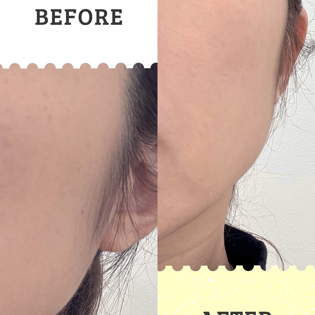 ディセンシア ホワイトF／L BBクリーム/DECENCIA/BBクリームを使ったクチコミ（3枚目）