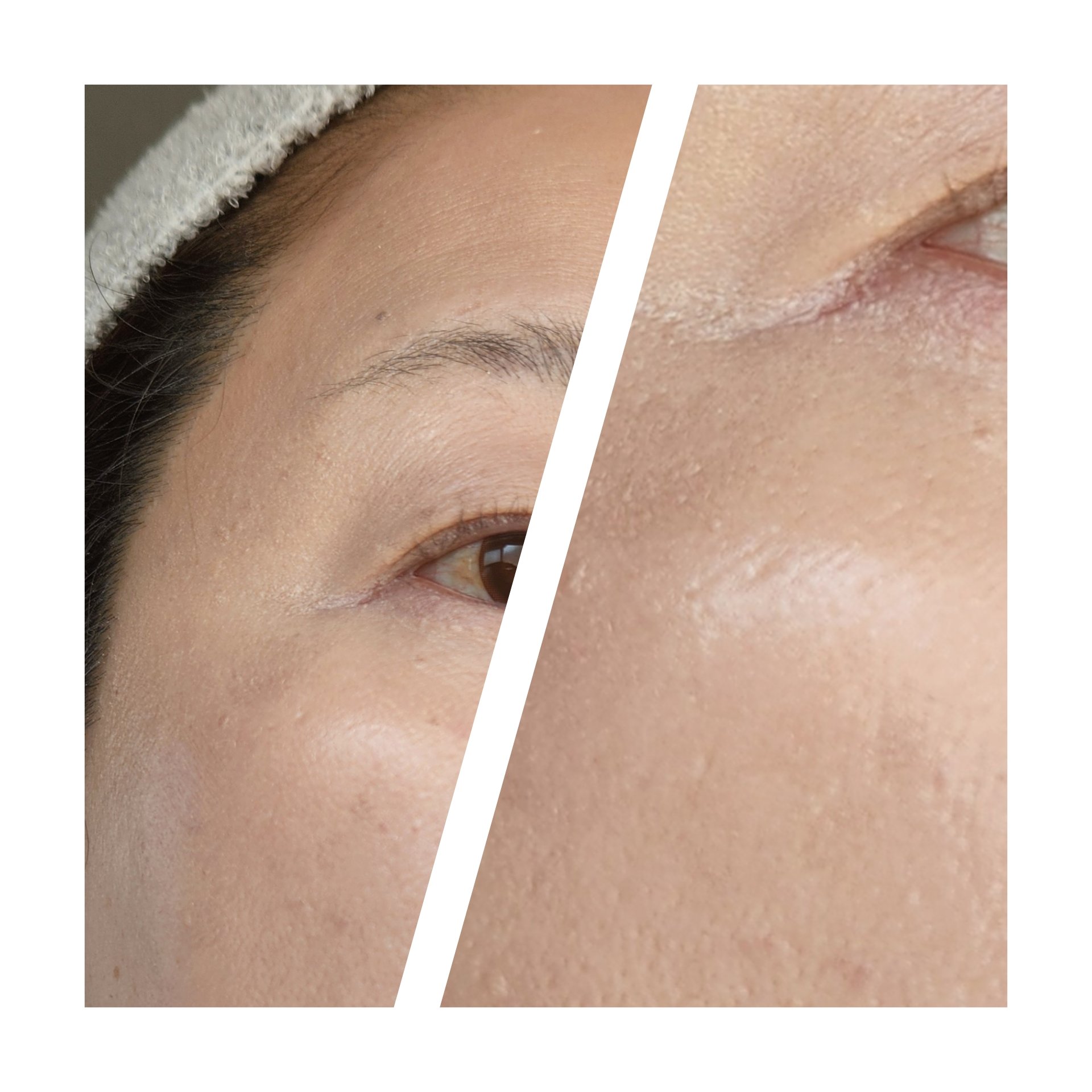 フィー クッションガラス ナチュラル/fwee/クッションファンデーションを使ったクチコミ（2枚目）