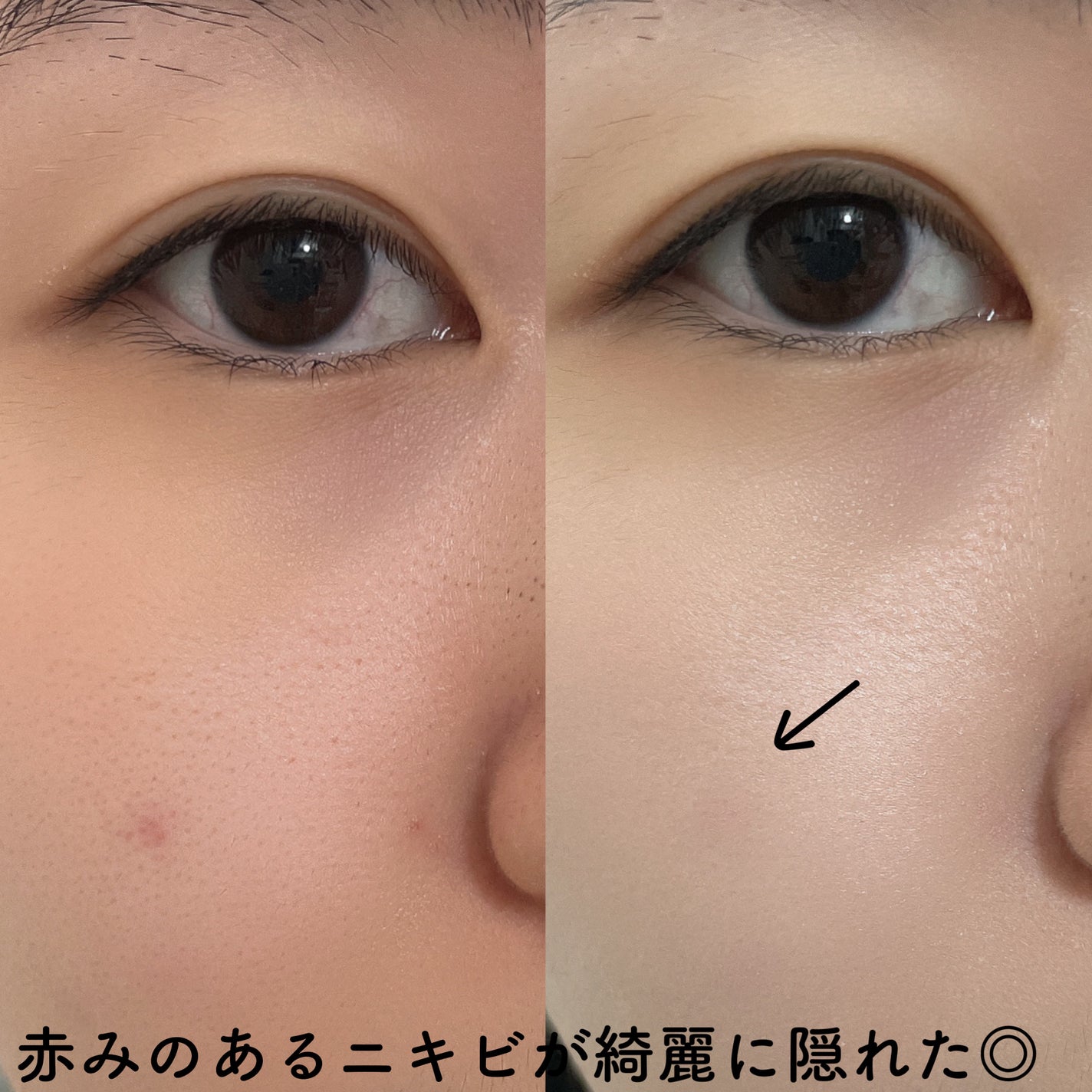 バイバイマイ ブレミッシュ コンシーラー/unleashia/リキッドコンシーラーを使ったクチコミ(4枚目)