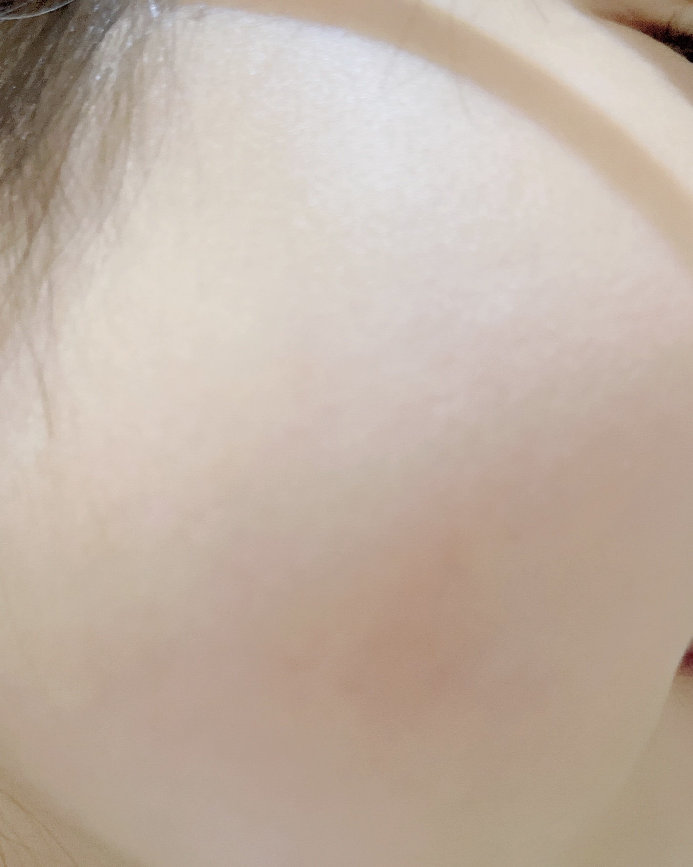 QuSomeレチノA/b.glen/美容液を使ったクチコミ（3枚目）